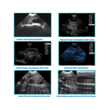 Portable Veterinary Ultrasound Machine